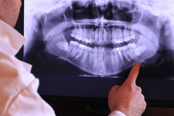 Best Emergency Denture Repair in Indianola, WA