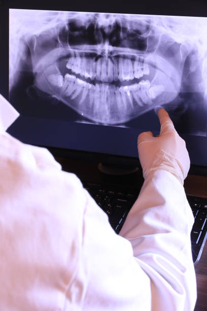 Best Emergency Root Canal Treatment in Indianola, WA